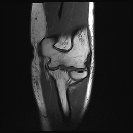 Click on the Serie image to view the images of Wieszt, Gnter